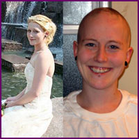 Helping Another - Women's Hair Loss Project