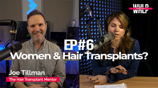 Joe Tillman - Women and Hair Transplants