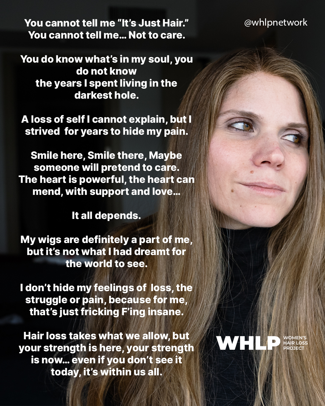Women S Hair Loss Project Help Hope And Understanding Women S Hair Loss Project Help Hope And Understanding